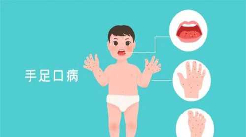 广州女大学生代孕|河池试管婴儿 第三代试管婴儿的大概流程是怎样的
